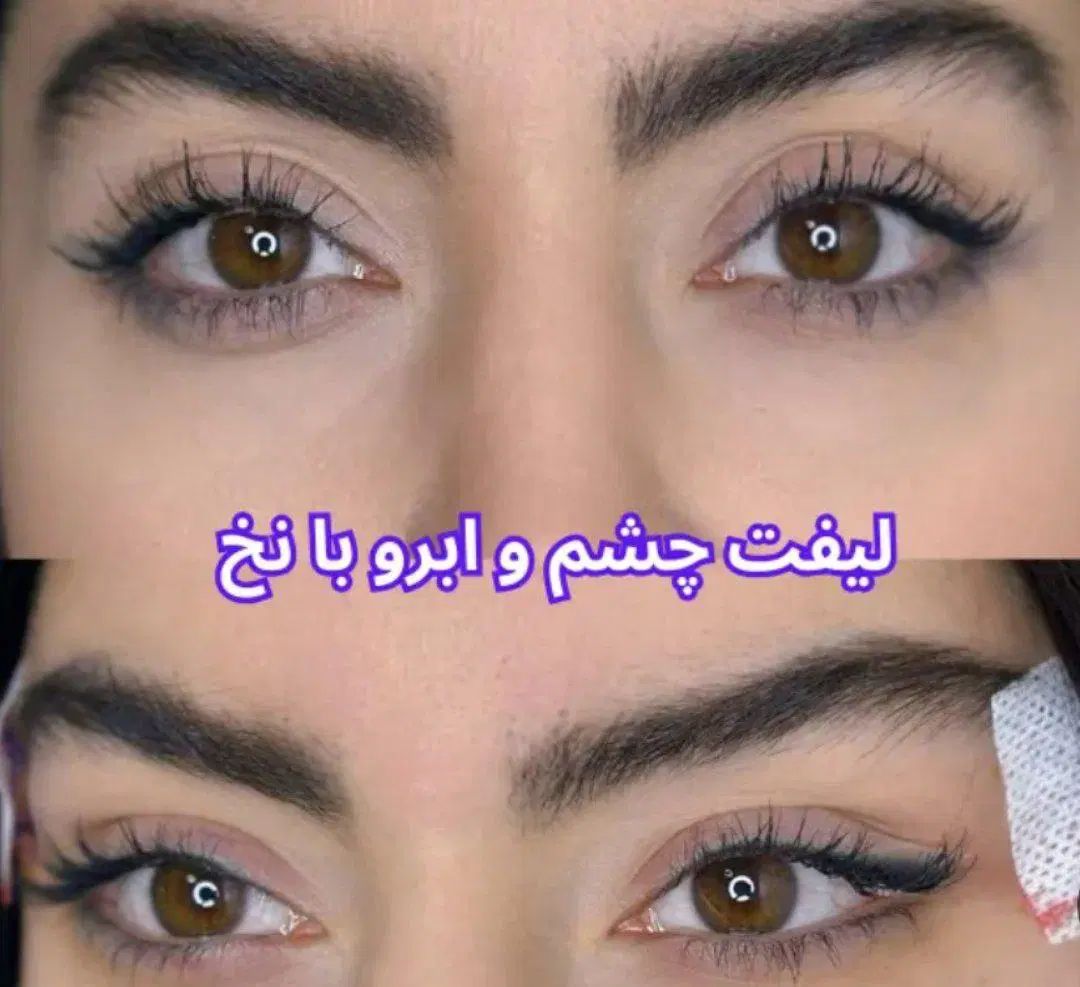 انجام تمامی خدمات زیبایی توسط پزشک زیبایی|خدمات آرایشگری و زیبایی|قم, باغ شازده|دیوار