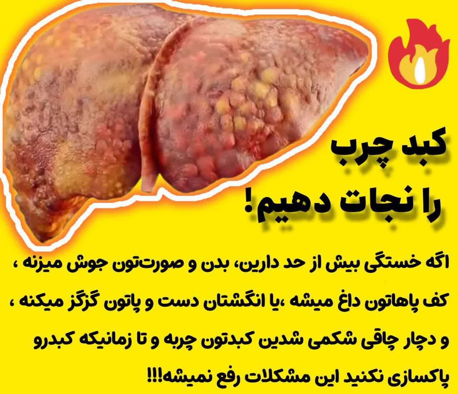 درمان خلط پشت حلق و کبدچرب و استرس و اعصاب|آرایشی، بهداشتی، درمانی|تهران, شهرک ولیعصر جنوبی|دیوار