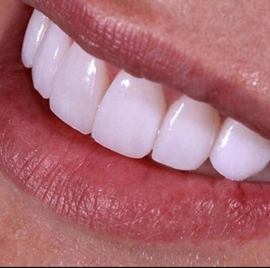 هر لبخند آغاز یک تغییر است|خدمات آرایشگری و زیبایی|رباطکریم, نصیرشهر|دیوار