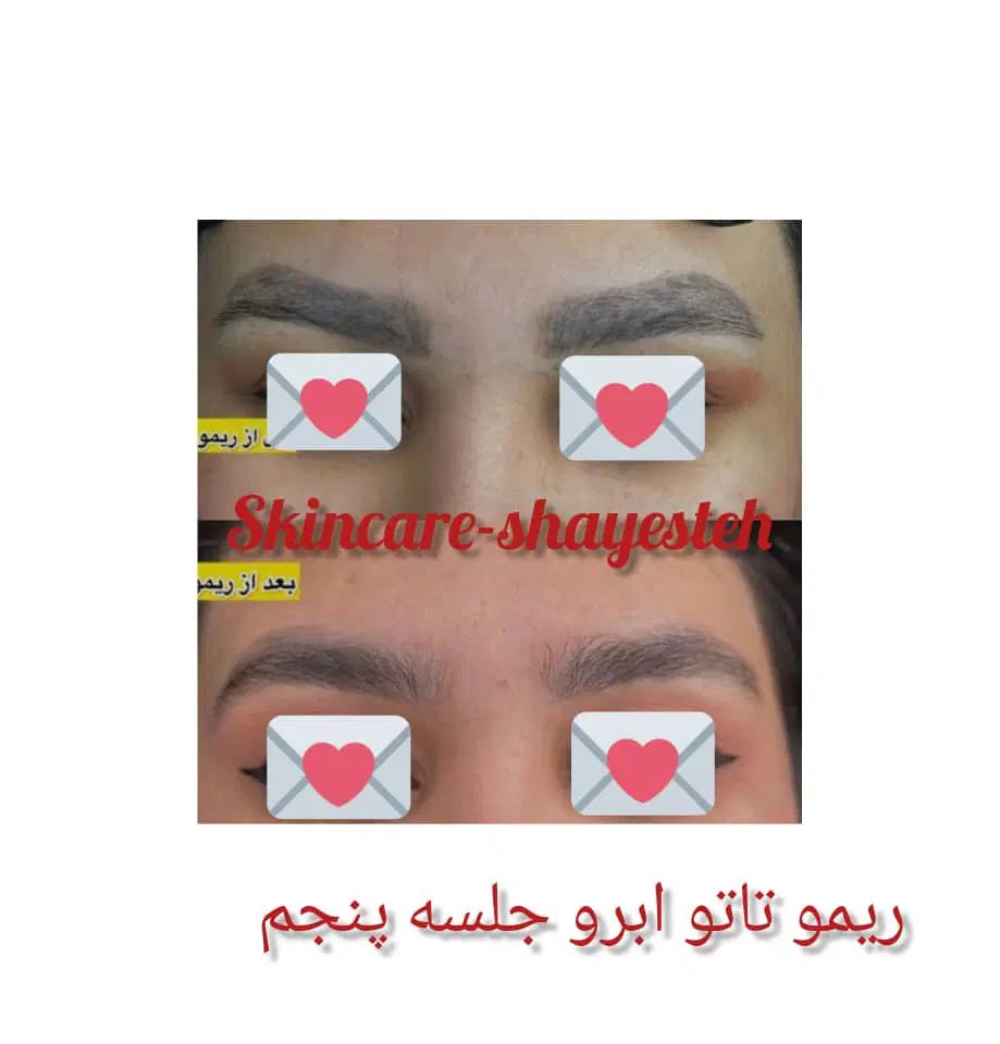 ریمو تاتو|خدمات آرایشگری و زیبایی|اصفهان, وحید|دیوار