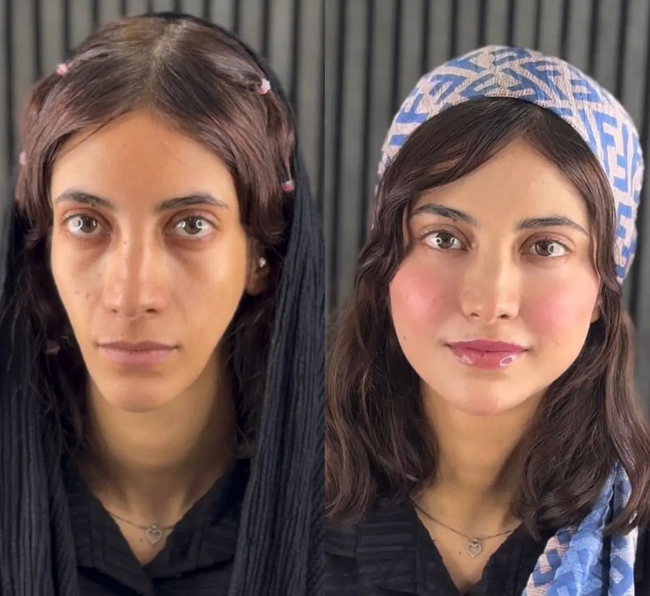 تخفیفات استثنایی ژل و بوتاکس در مطب زیبایی|خدمات آرایشگری و زیبایی|قم, زنبیل آباد|دیوار