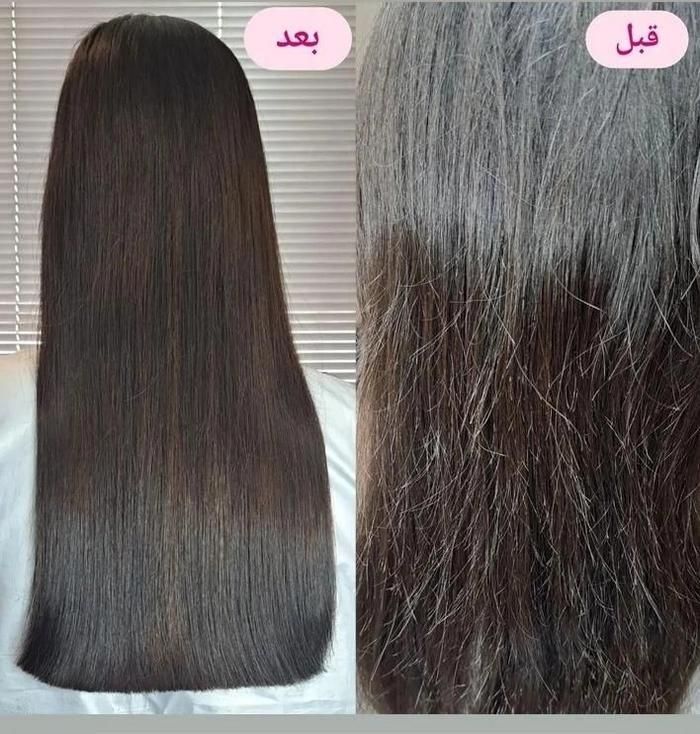 موخوره گیری و تراپی موی شگفتانه|خدمات آرایشگری و زیبایی|قم, سالاریه|دیوار