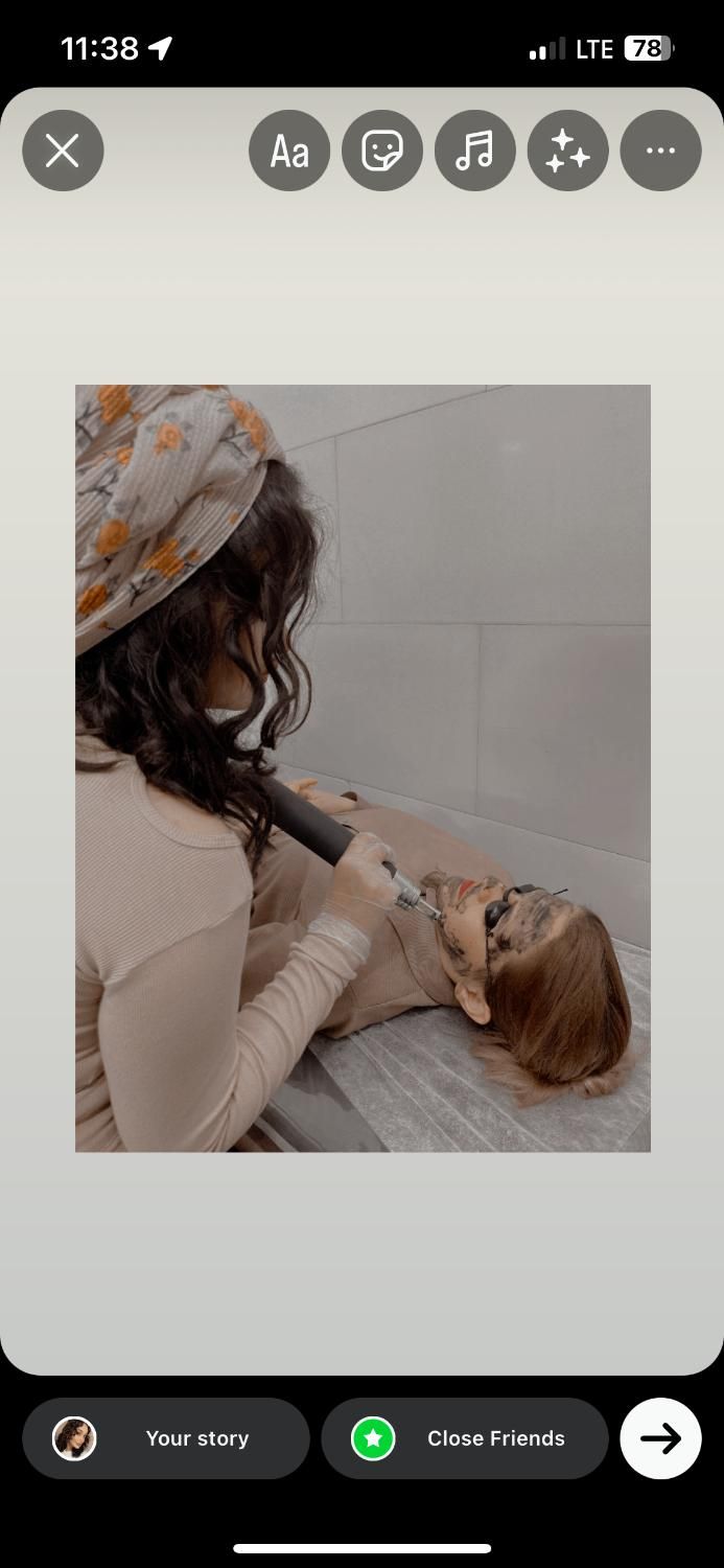 لیزرکیوسوییچ وایتینینگ پاکسازی هالیوودی سفید کننده|خدمات آرایشگری و زیبایی|اسلام‌شهر, زرافشان|دیوار