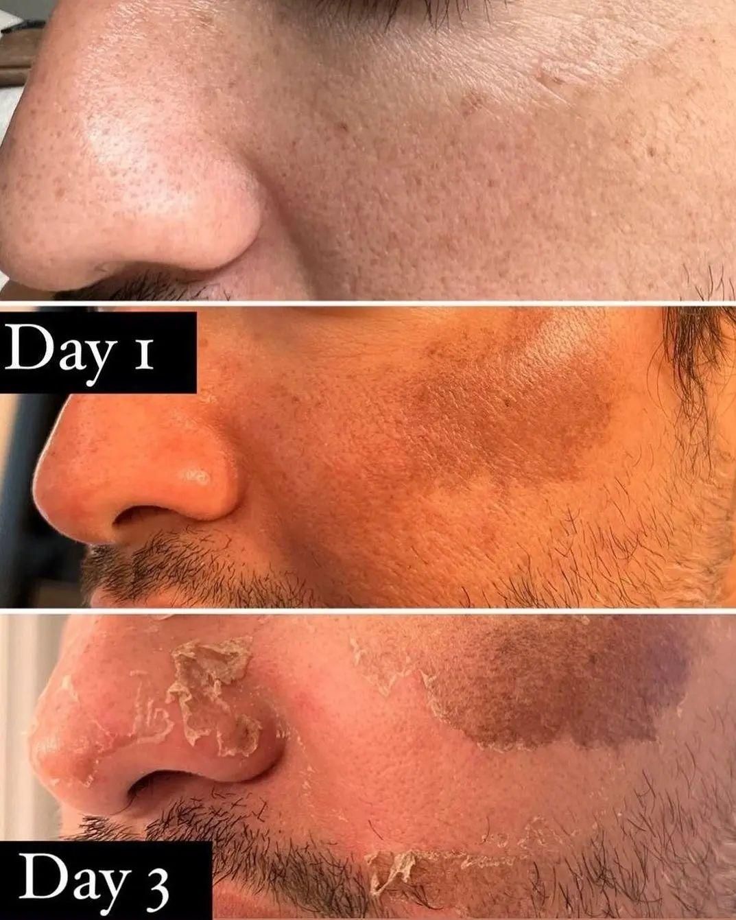 آموزش تکنیک پوست ماری|خدمات آموزشی|تهران, امیریه|دیوار