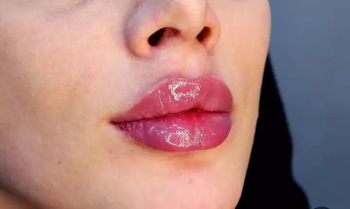اف ویژه اموزش وخدمات ژل بوتاکس کراتین خال پوست|خدمات آرایشگری و زیبایی|دزفول, |دیوار