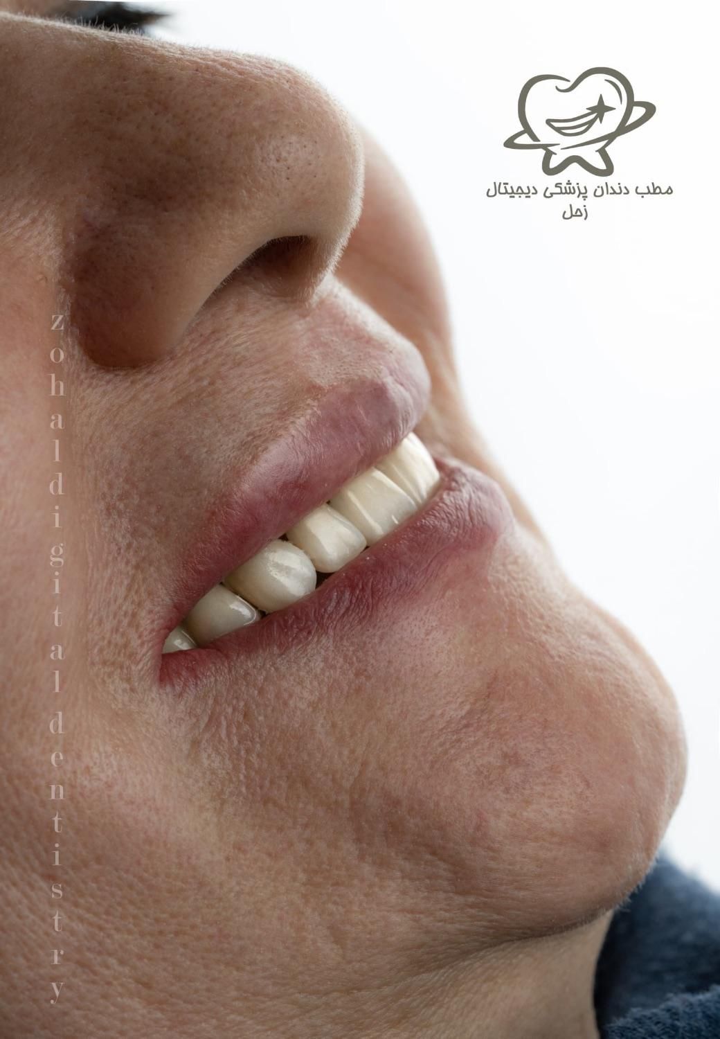 دستیار دندان‌پزشک شیفت شب|استخدام درمانی، زیبایی، بهداشتی|تهران, ستارخان|دیوار
