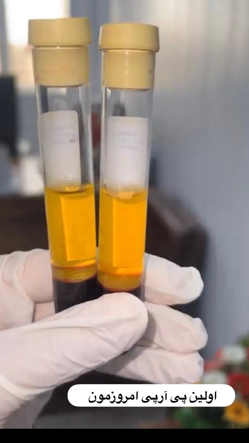 جشنواره پی آرپی ژل و بوتاکس مزوتراپی بلفارو|خدمات آرایشگری و زیبایی|اهواز, کیانپارس |دیوار