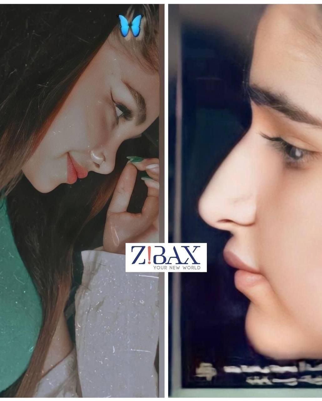 جراحی بینی در شیراز/نوبتگیری  +مشاور|خدمات آرایشگری و زیبایی|داراب, |دیوار