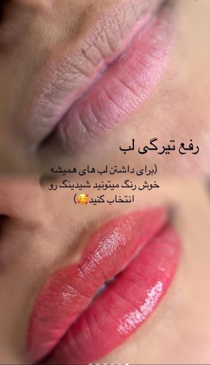 آموزش پک کامل تاتوصورت(فیبروزرژلب و..)دکاپاژوریموو|خدمات آموزشی|گرگان, |دیوار