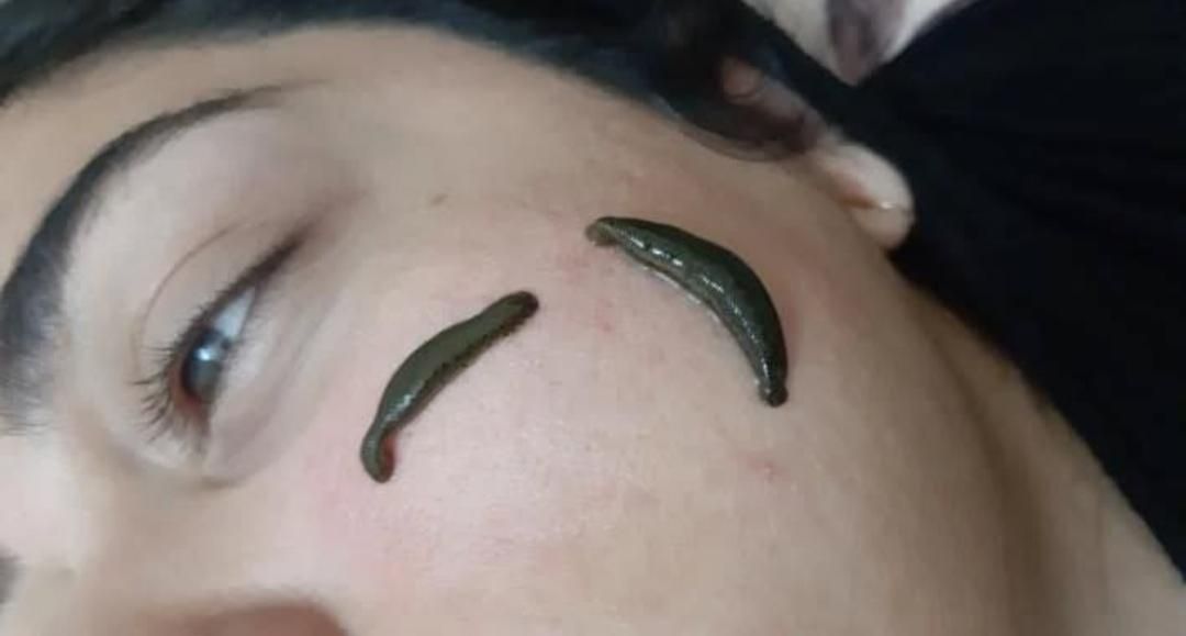 چکاپ کلی خدمات زیبایی طب سنتی حجامت زالو بادکش فصد|خدمات آرایشگری و زیبایی|اصفهان, برازنده|دیوار