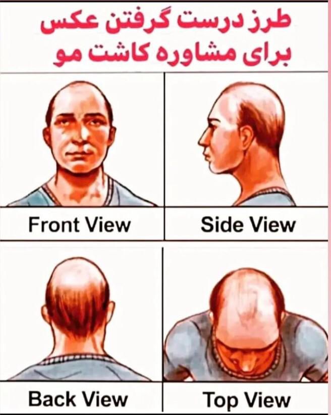 کاشت مووابرو مادام العمر درشیراز برای اصفهانی‌ها|خدمات آرایشگری و زیبایی|اصفهان, مرداویج|دیوار