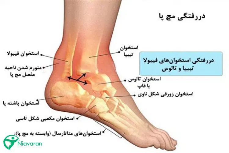 درمان دیسک ،سیاتیک،کتف و گردن،زانو و شکسته بندی|خدمات آرایشگری و زیبایی|تبریز, |دیوار