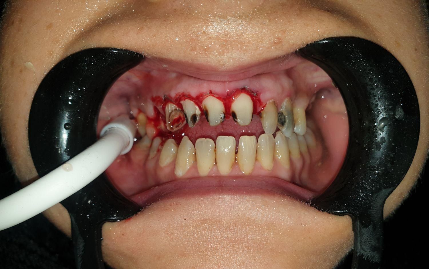 خدمات دندانپزشکی برلیان|خدمات آرایشگری و زیبایی|بانه, |دیوار