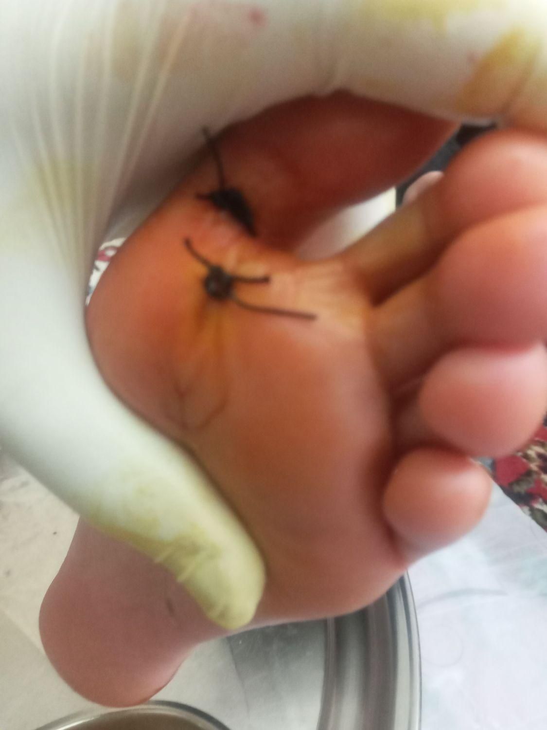 انواع تزریقات وپانسمان فصدبخیه وفیزیوتراپی درمنزل|خدمات آرایشگری و زیبایی|خرم‌آباد, |دیوار