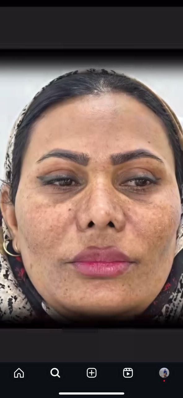 کرم لک سفید کننده فیلیپینی|آرایشی، بهداشتی، درمانی|بندرعباس, |دیوار