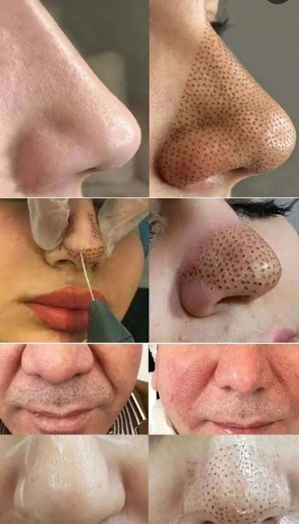 جشنواره تزریق ژل و بوتاکس در مطب با۴۰درصد تخفیف|خدمات آرایشگری و زیبایی|کرمانشاه, |دیوار