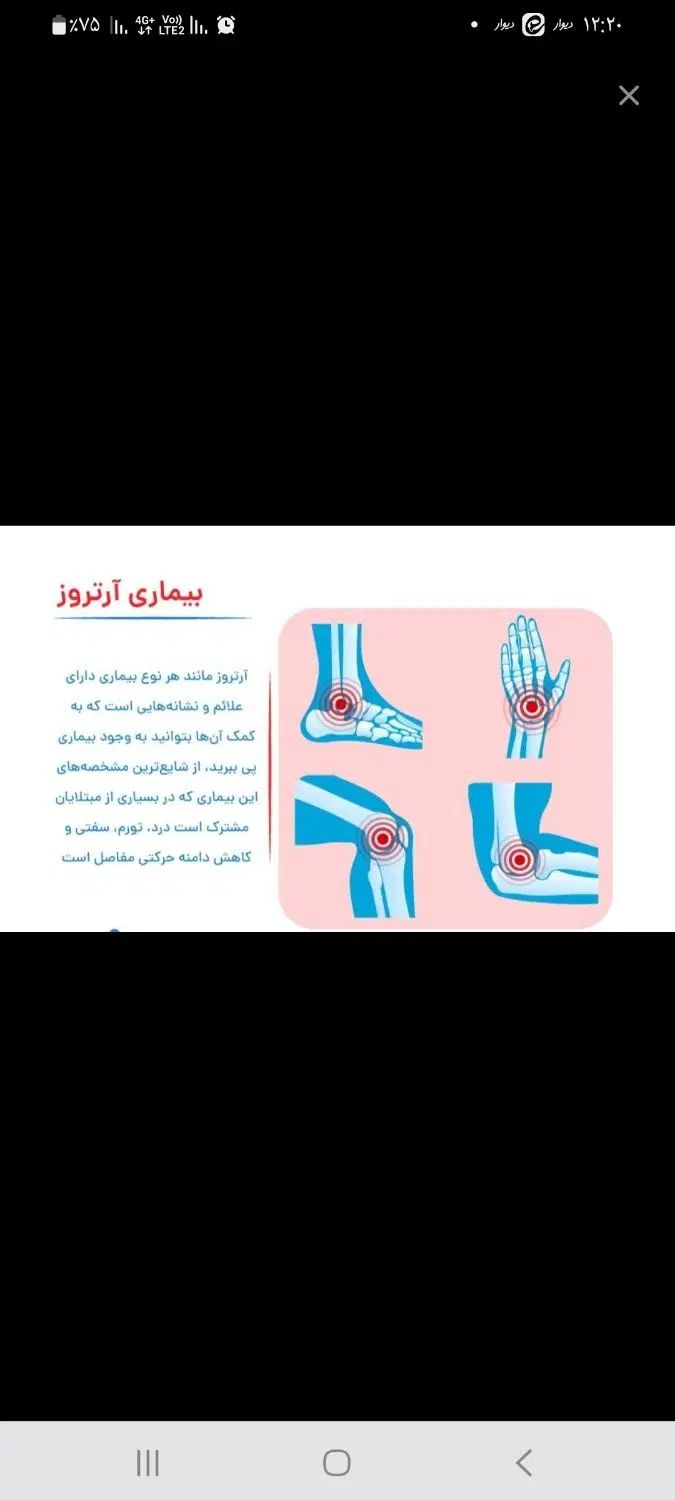 درمان آرتروز وپوکی استخوان|خوردنی و آشامیدنی|تهران, اسکندری|دیوار