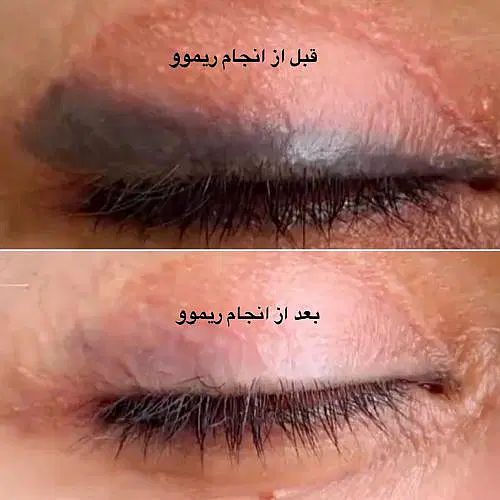 ریموو ریمو ابرو خط چشم پاک کردن رفع قرمزی|خدمات آرایشگری و زیبایی|شاهین‌شهر, عطار|دیوار