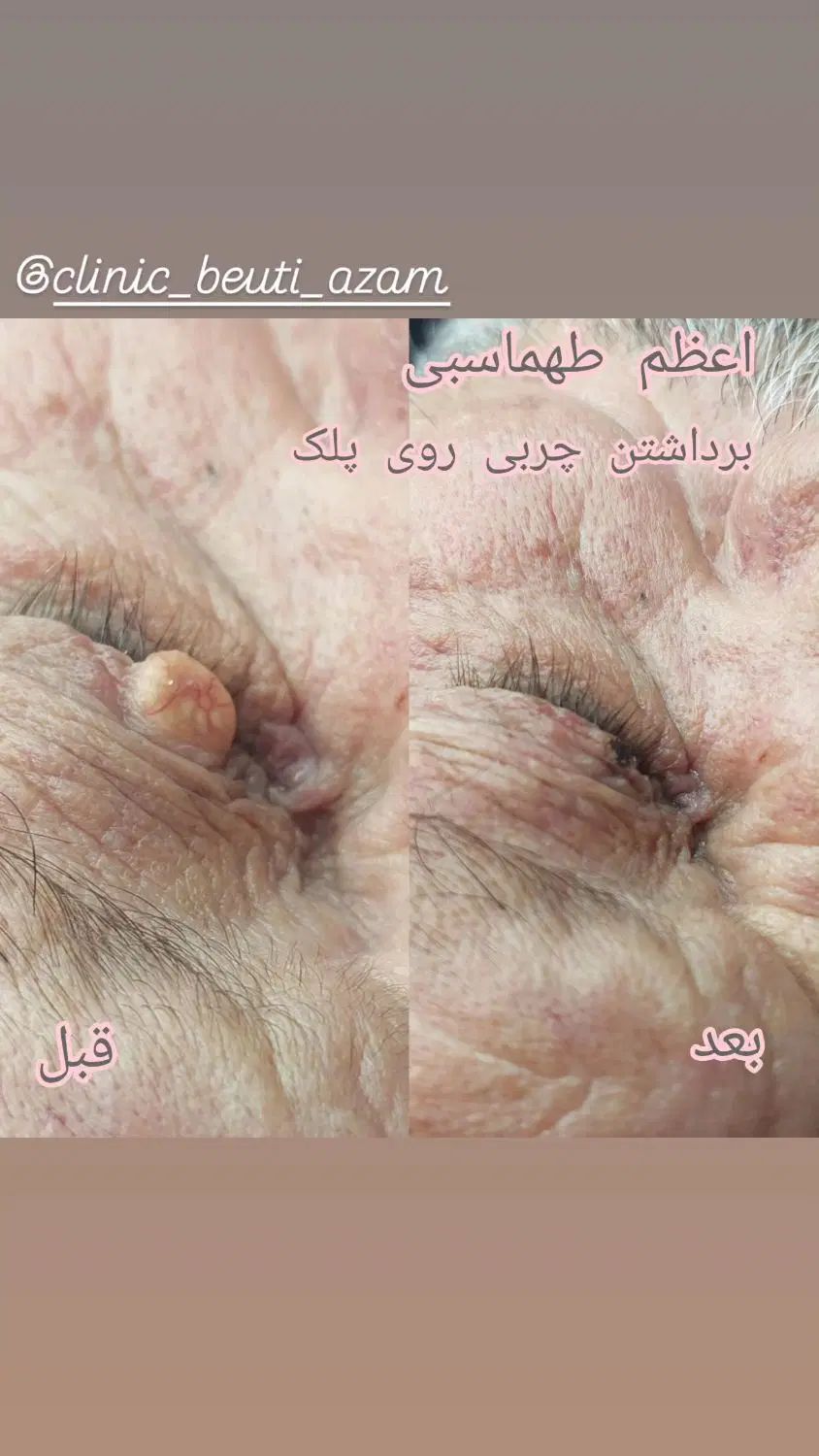 خدمات تخصصی زیبایی پوست ومو (اعظم طهماسبی)|خدمات آرایشگری و زیبایی|ایذه, |دیوار