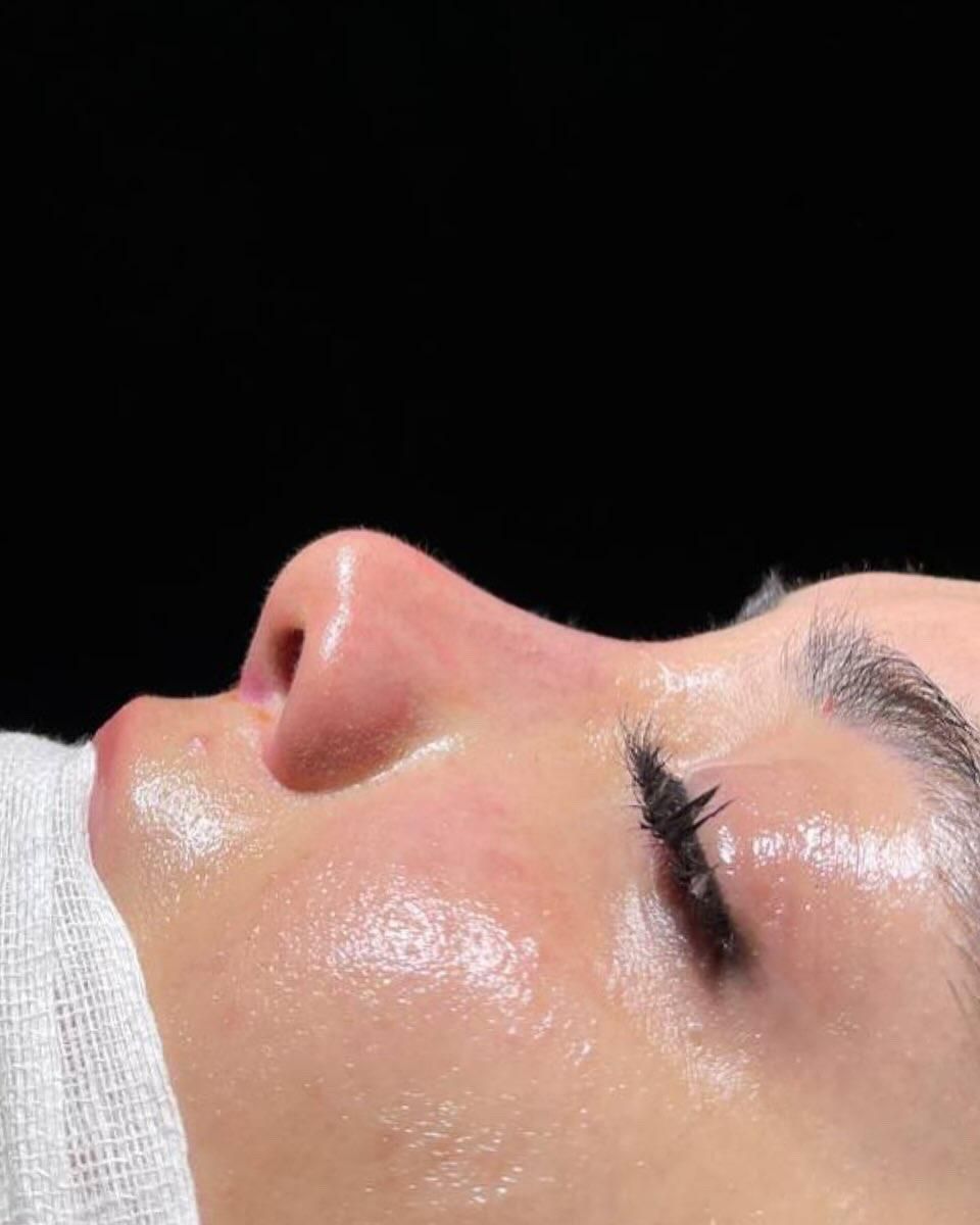 عمل جراحی بینی با تخفیف ویژه در فستیوال تابستانه|خدمات آرایشگری و زیبایی|تهران, فلسطین (میدان انقلاب)|دیوار