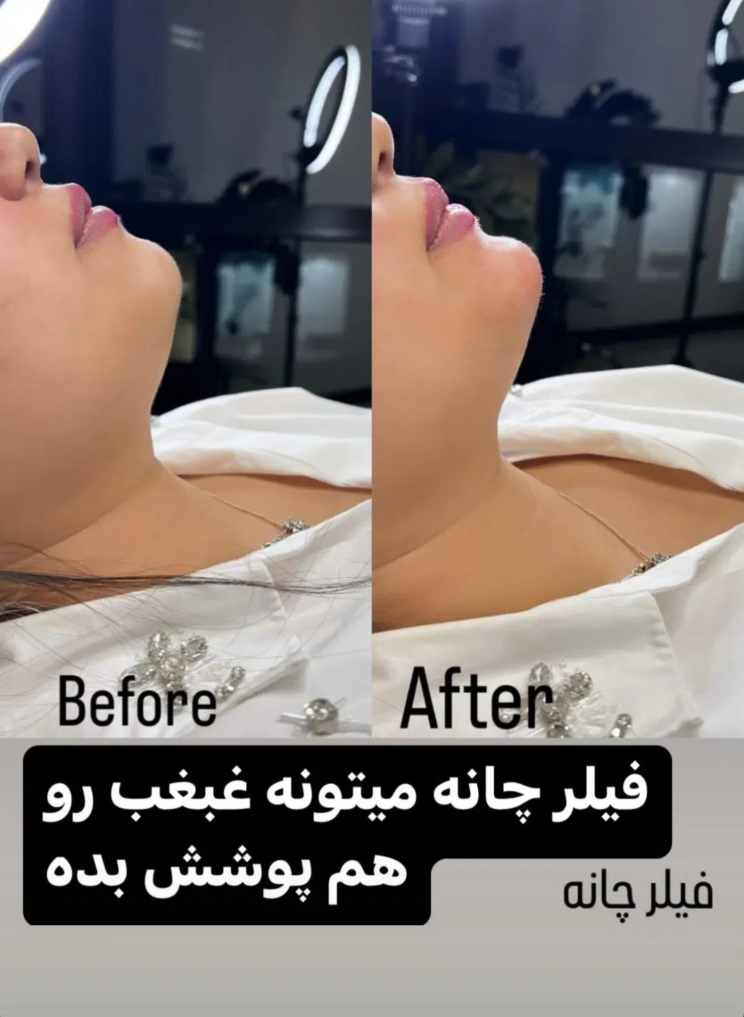 کلینیک لیزرمو بوتاکس تزریق  ژل لب روسی فیلر لیفت|خدمات آرایشگری و زیبایی|تهران, صادقیه|دیوار