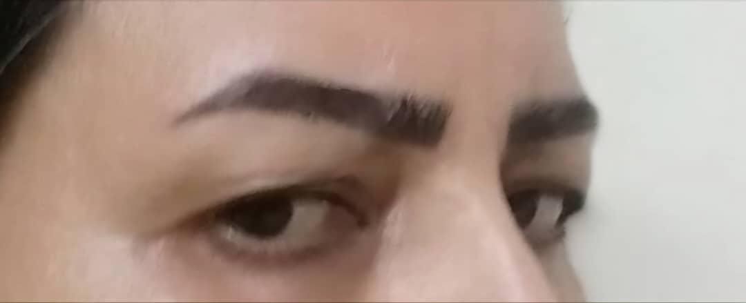 بلفاروبلاستی پلک بالا و پایین....اقساطی|خدمات آرایشگری و زیبایی|اصفهان, خوراسگان|دیوار