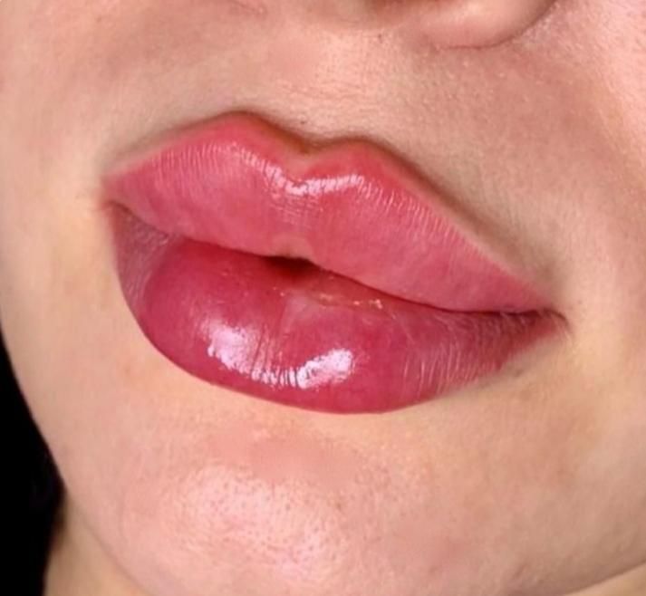لیفت نخ انزیم ژل وبوتاکس پلاسما تتوبدن فشیال...|خدمات آرایشگری و زیبایی|قم, باجک دو|دیوار