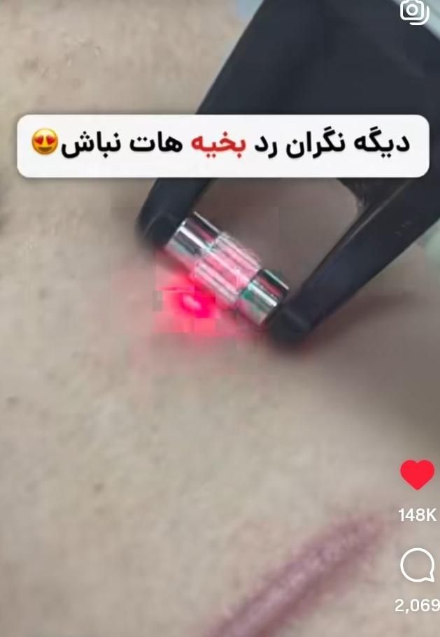 پاکسازی و فیشال/ آقایان و بانوان|خدمات آرایشگری و زیبایی|هشتگرد, هشتگرد قدیم|دیوار