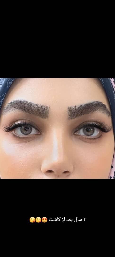 کاشت ابرو|خدمات آرایشگری و زیبایی|تهران, ونک|دیوار