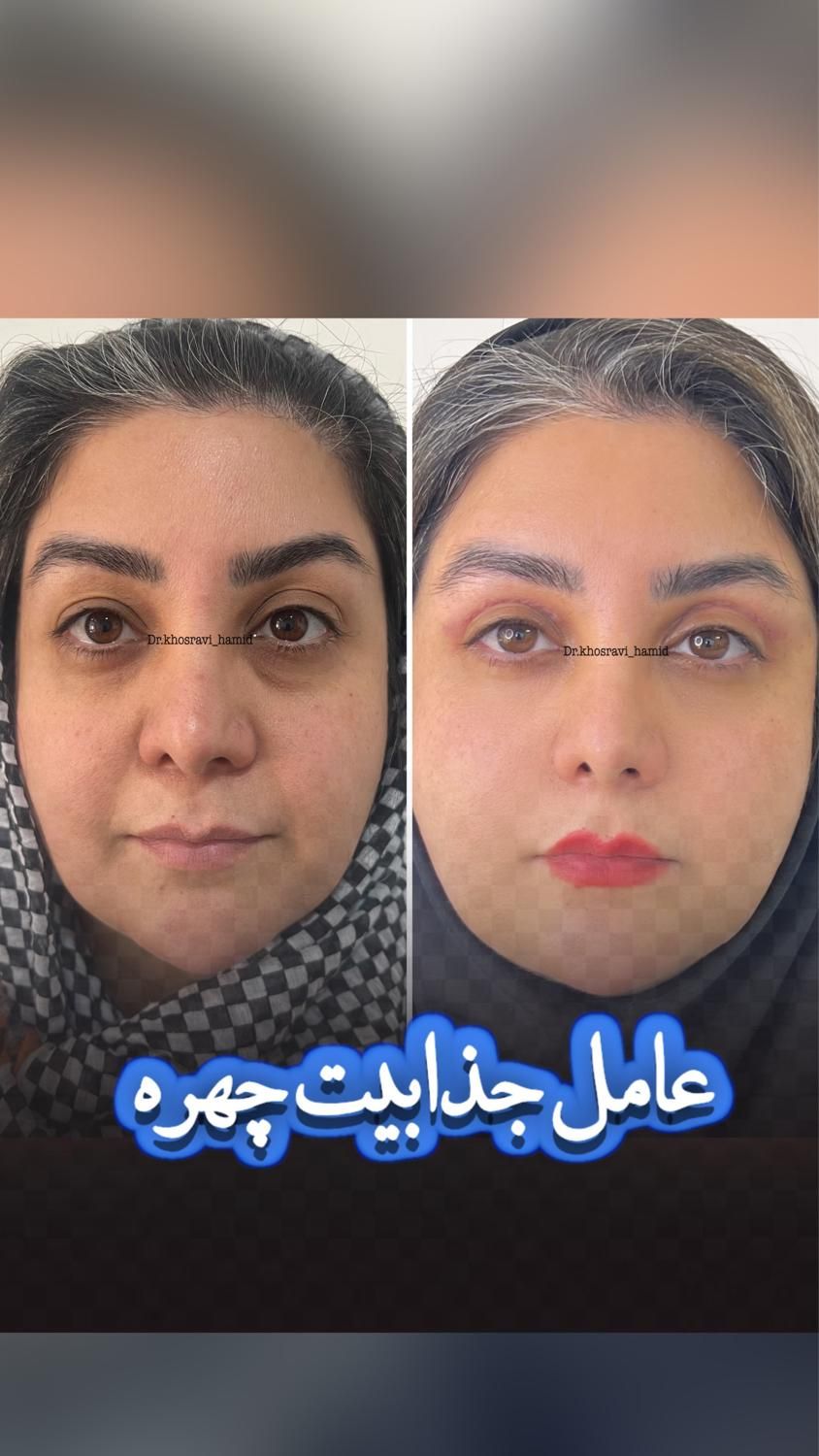 کلینیک زیبایی و جراحی بلفاروپلاستی و بینی|خدمات آرایشگری و زیبایی|فردیس, طالقانی|دیوار