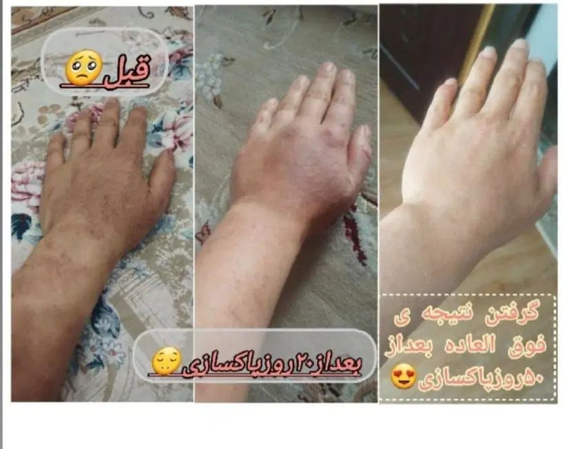 میخوای بدونی داخل بدنت چه مشکلی داره|خوردنی و آشامیدنی|مشهد, ارشاد|دیوار