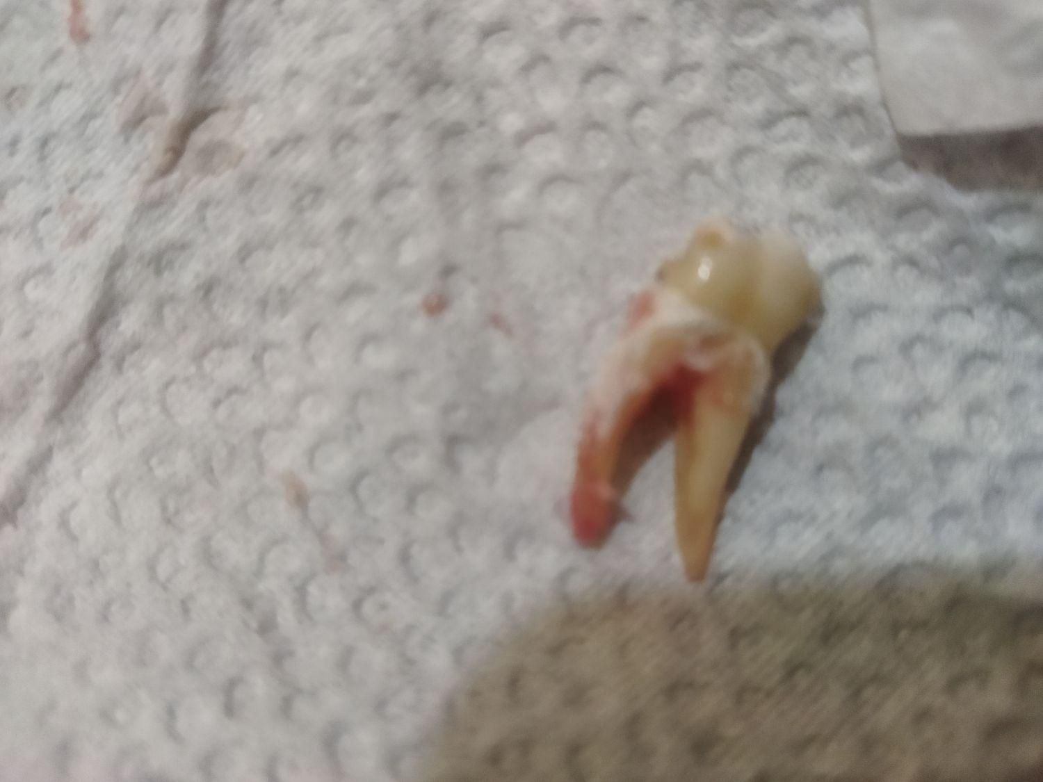 کشیدن دندان های خوی و سلماس|خدمات آرایشگری و زیبایی|خوی, |دیوار