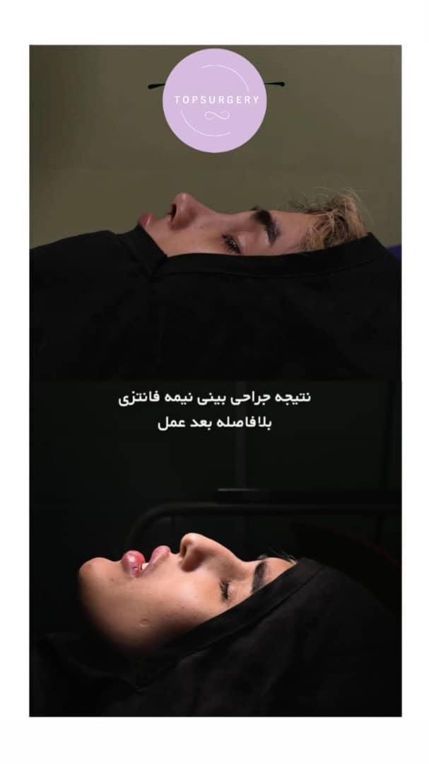 جراحی زیبایی اقساط|خدمات آرایشگری و زیبایی|تهران, امیریه|دیوار