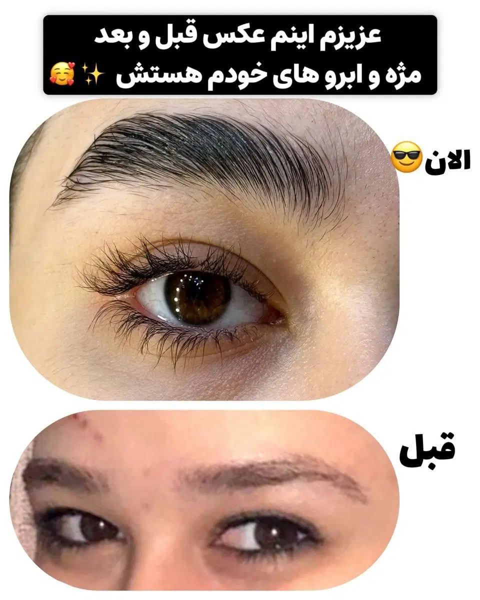 تقویت مژه|آرایشی، بهداشتی، درمانی|تهران, زرکش|دیوار
