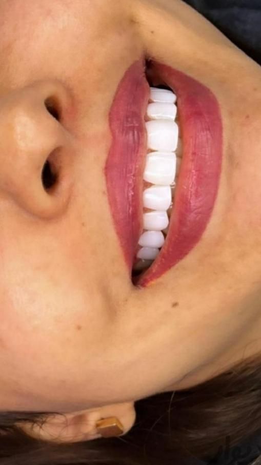 خدمات دندانپزشکی طرح همایتی(نیمه رایگان)|خدمات آرایشگری و زیبایی|کرمانشاه, |دیوار