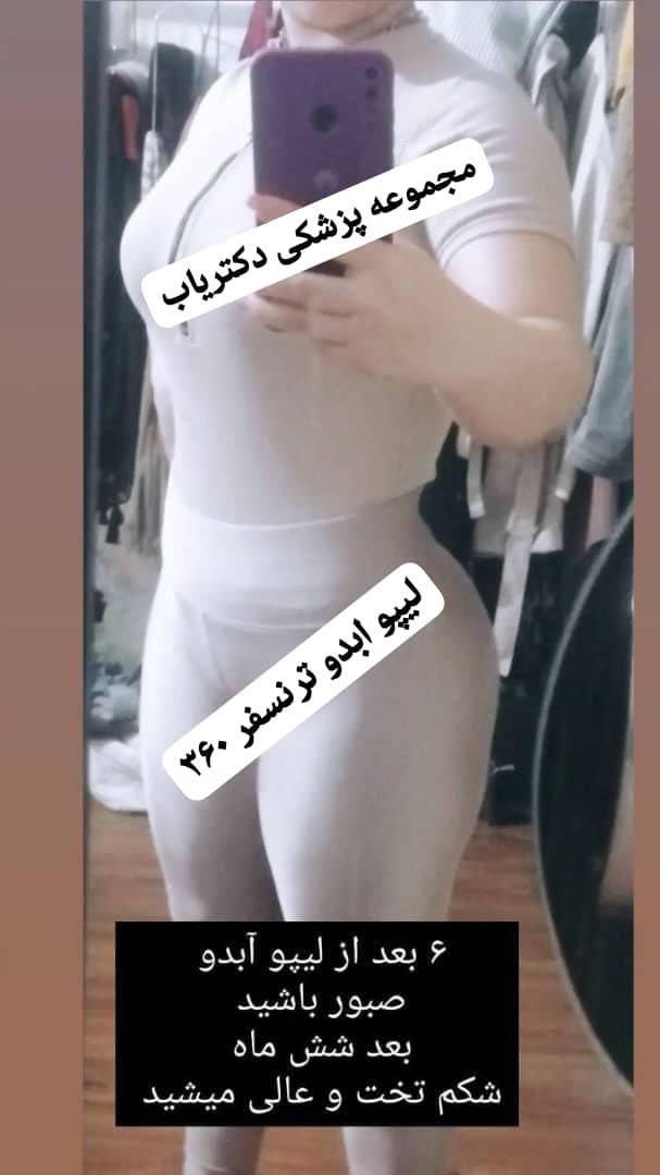 جراحی زیبایی عمل های تخصصی پیکرتراشی دکتریاب|خدمات آرایشگری و زیبایی|شیراز, زند|دیوار