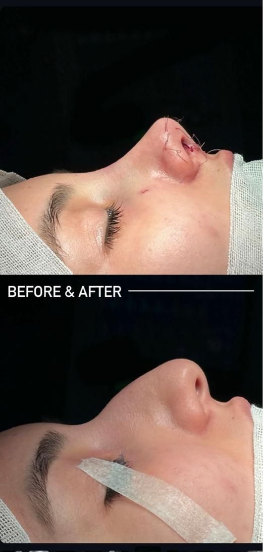 عمل جراحی بینی /لیفت صورت/پلک|خدمات آرایشگری و زیبایی|کرج, عظیمیه|دیوار