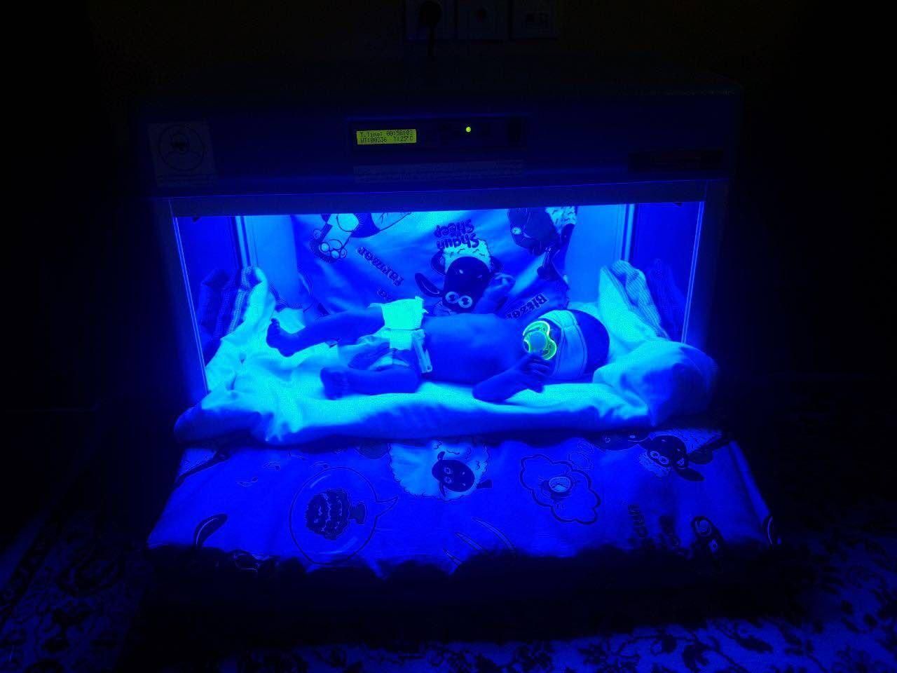 اجاره دستگاه درمان زردی نوزاد  / فتوتراپی پیشرفته|خدمات آرایشگری و زیبایی|کرمانشاه, |دیوار