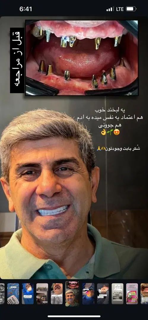 مرکز ایمپلنت شرق|خدمات آرایشگری و زیبایی|تهران, چهارصد دستگاه|دیوار