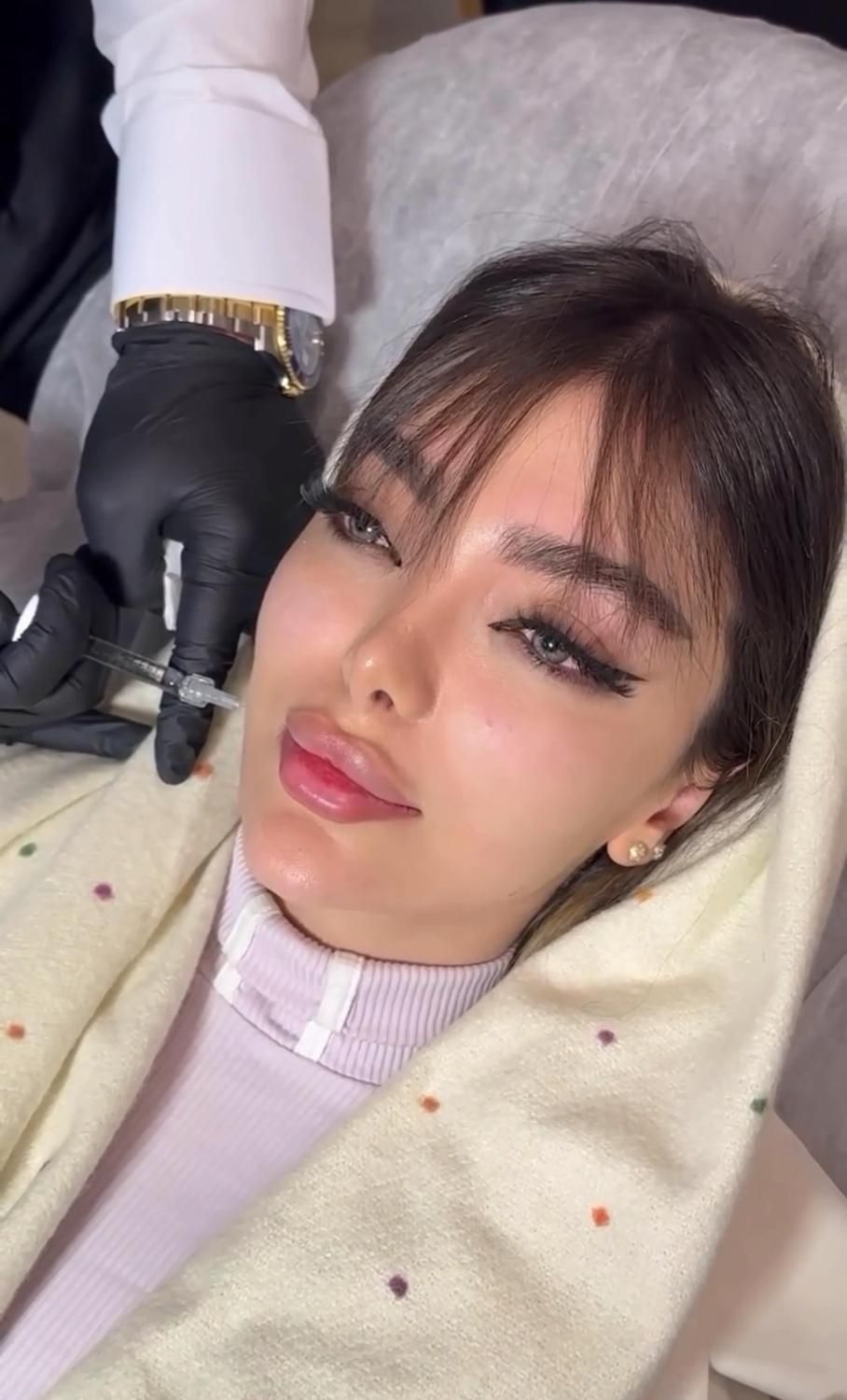 ژل لب روسی بوتاکس کانتورینگ و مادلینگ صورت لیفت نخ|خدمات آرایشگری و زیبایی|تهران, سعادت‌آباد|دیوار