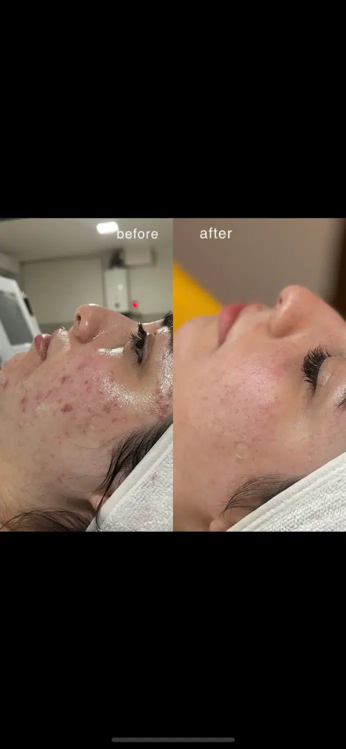 پاکسازی عمیق ‌وتخصصی‌ صورت|خدمات آرایشگری و زیبایی|اصفهان, جلفا|دیوار