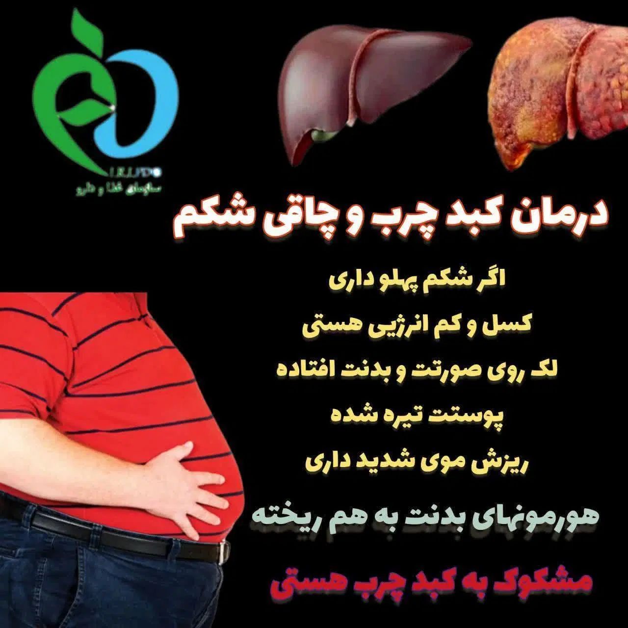 اضافه وزن داری|آرایشی، بهداشتی، درمانی|اصفهان, بابوکان|دیوار