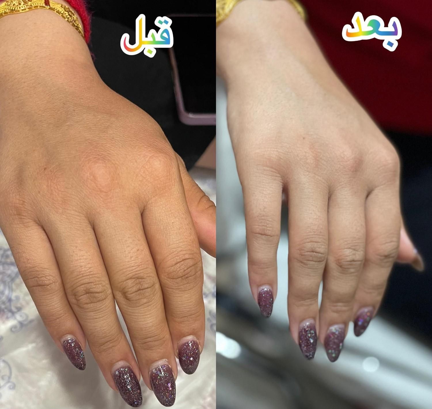 پارافین تراپی/رفع خشکی و تیرگی/لایه های شاخی/پوست|خدمات آرایشگری و زیبایی|شیراز, نصر|دیوار