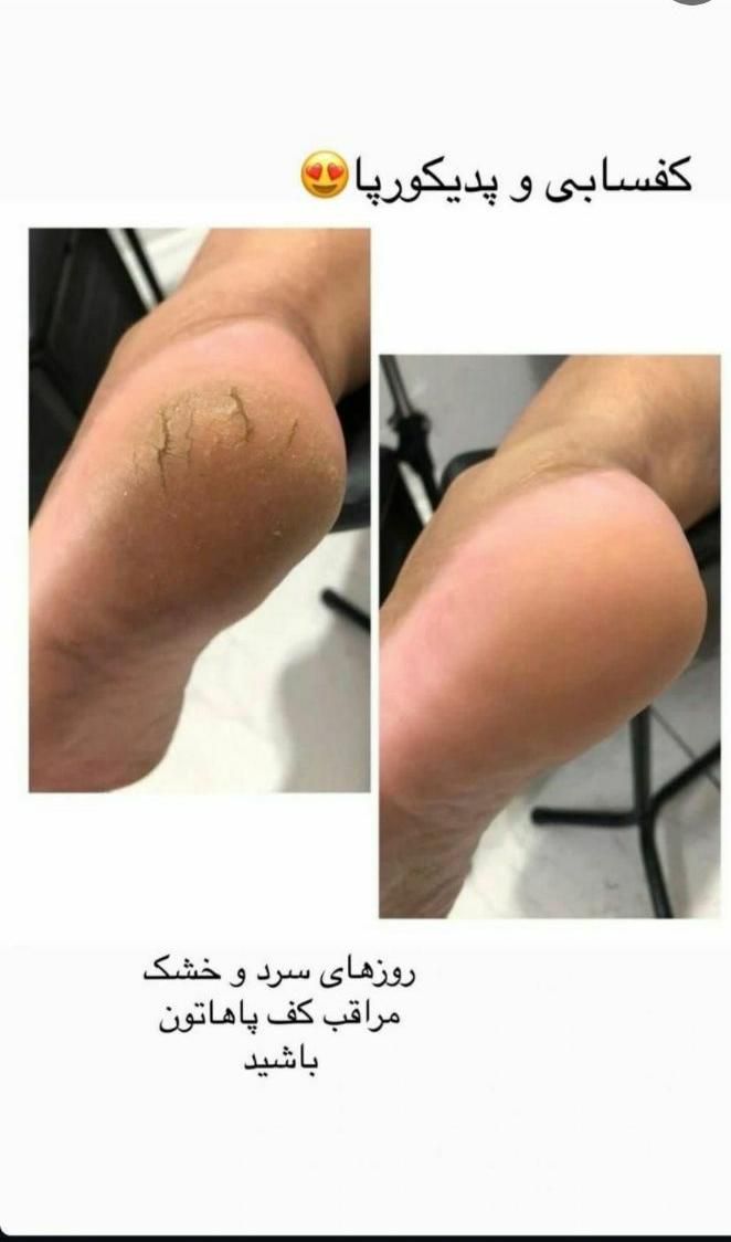 آموزش و خدمات پرسینگ و پدیکورتراپی تخفیف ۸۰ درصدی|خدمات آرایشگری و زیبایی|کرج, باغستان|دیوار