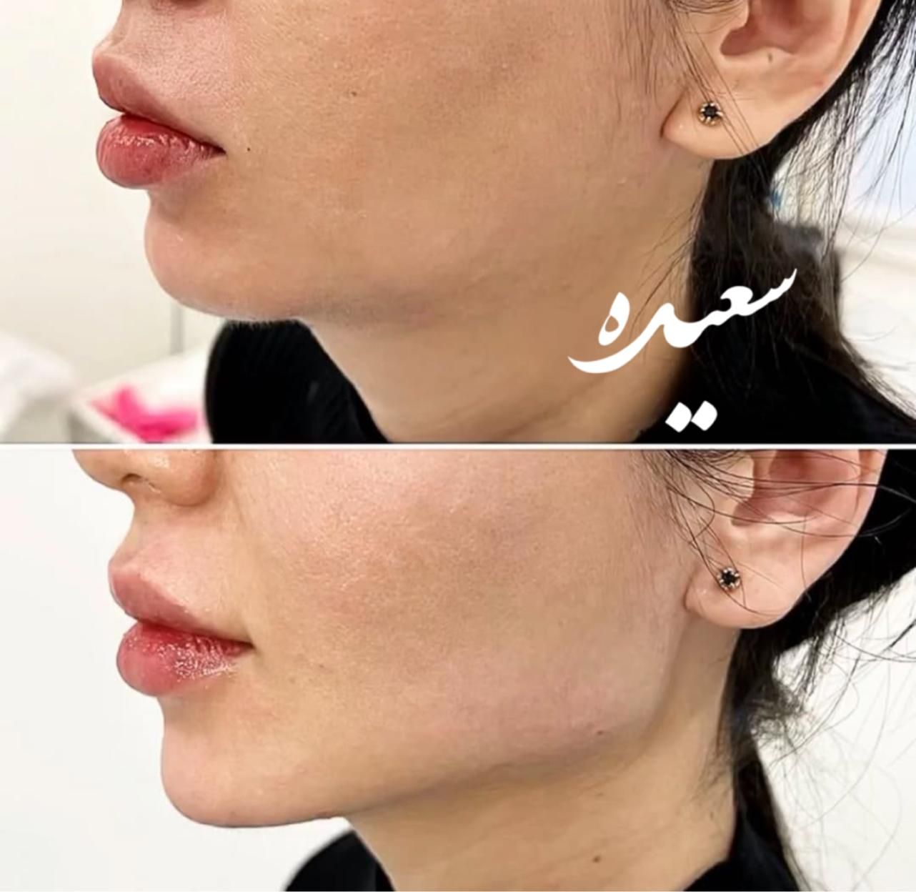 خدمات ژل عربی ‌خلیجی زیبادرکلینیک|خدمات آرایشگری و زیبایی|پرند, فاز ۵|دیوار