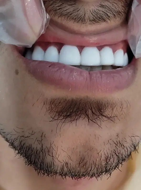 دندانپزشکی با تخفیف ٪40|خدمات آرایشگری و زیبایی|بروجرد, |دیوار