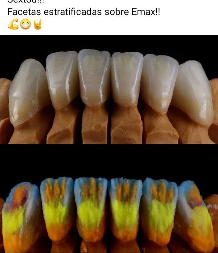 آموزش تخصصی پرسلن دندان(پودرگذاری)|خدمات آموزشی|اصفهان, همدانیان|دیوار