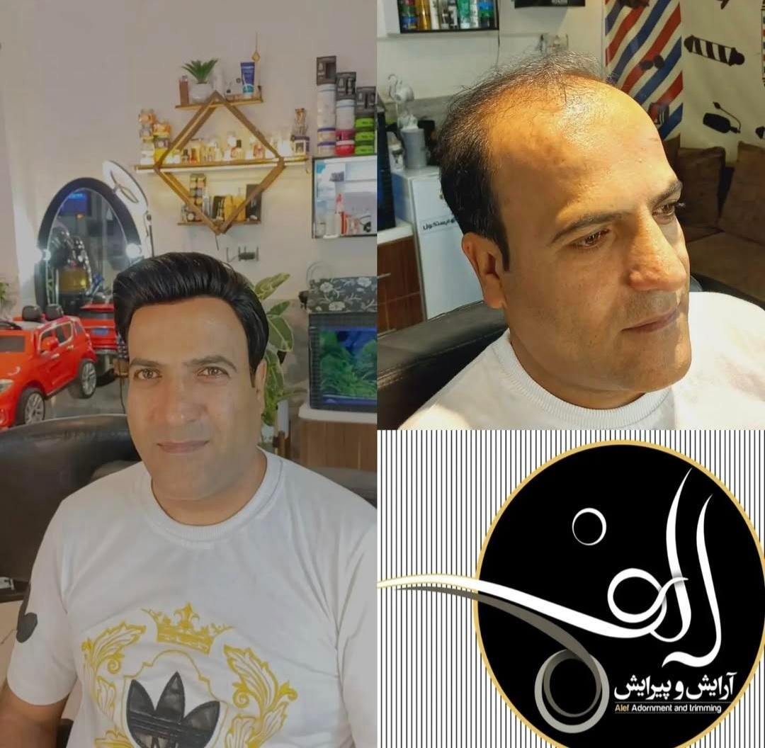 کلینیک پروتز دائمی مو ترمیم مو الف|خدمات آرایشگری و زیبایی|بیرجند, |دیوار