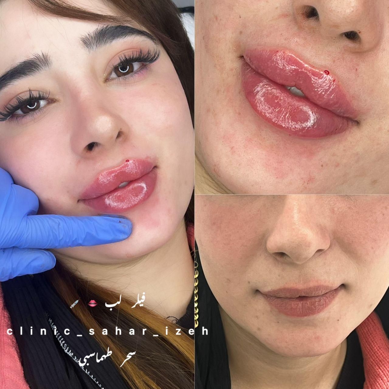 مرکز لیزر غزل|خدمات آرایشگری و زیبایی|ایذه, |دیوار