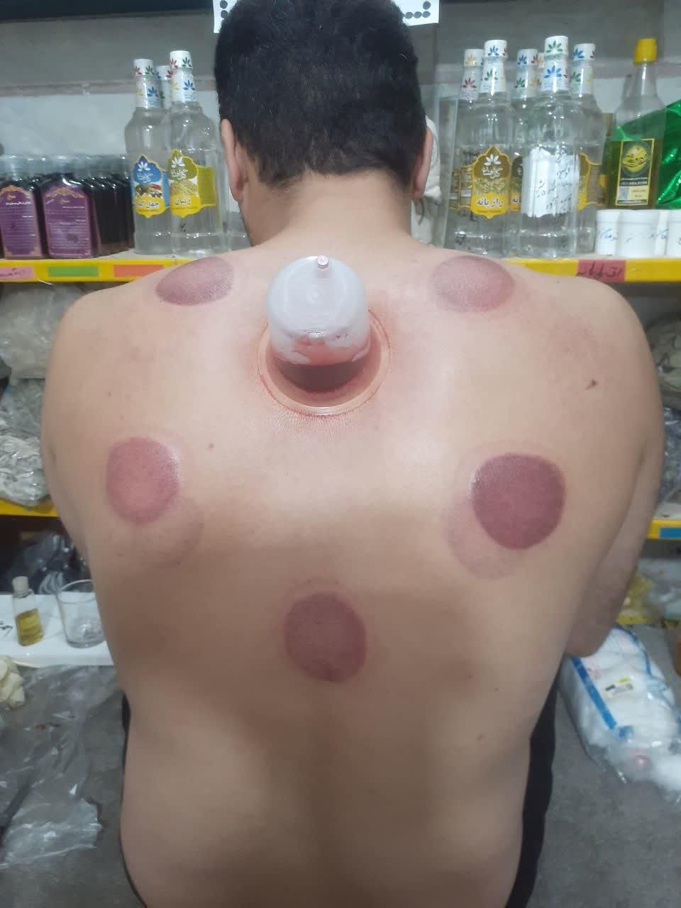 حجامت اصولی در منزل ومطب|خدمات آرایشگری و زیبایی|رشت, حومه رشت|دیوار